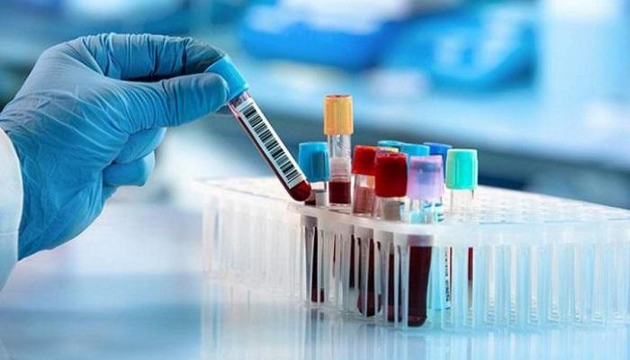 Global Cord Blood Banking Services Market Research 2020-2026 by Major Players Cryo-Cell International, Virgin Health Bank, Cord Blood America