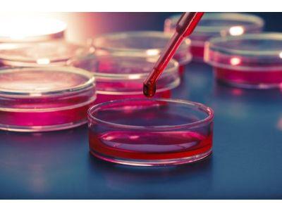 Cell and Tissue Culture Supplies Market