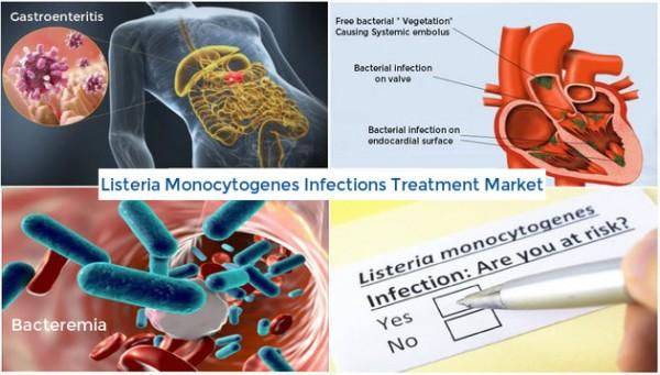 Listeria Monocytogenes Infections Treatment Market