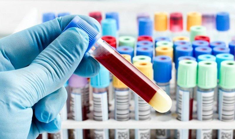 Survey: Impact Of Covid-19 On Blood Preparation Market