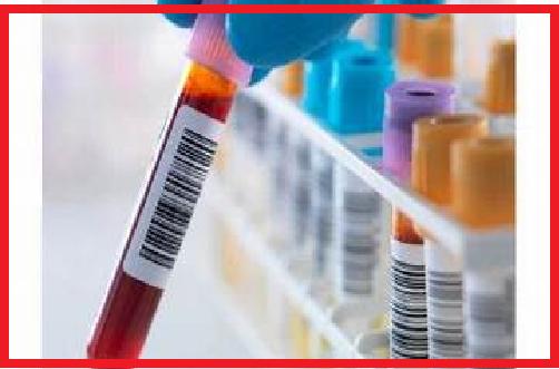 Covid-19 Impact on Global Blood Collection Tubes for Liquid Biopsy Market Size, Status and Forecast 2020-2026