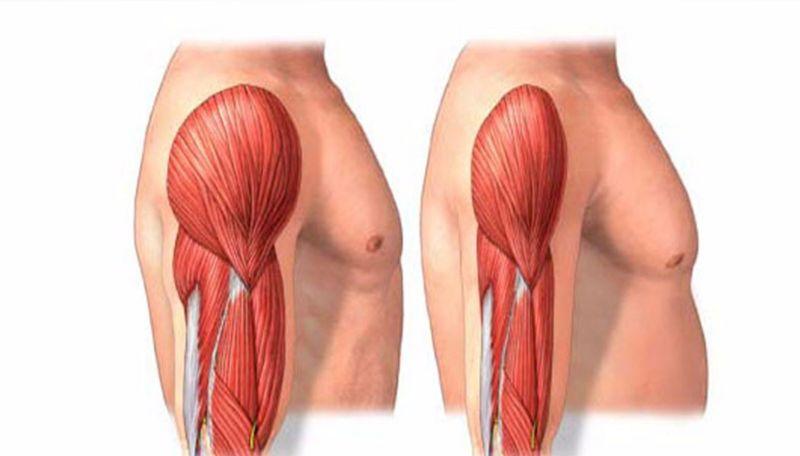 Sarcopenia Treatment Market