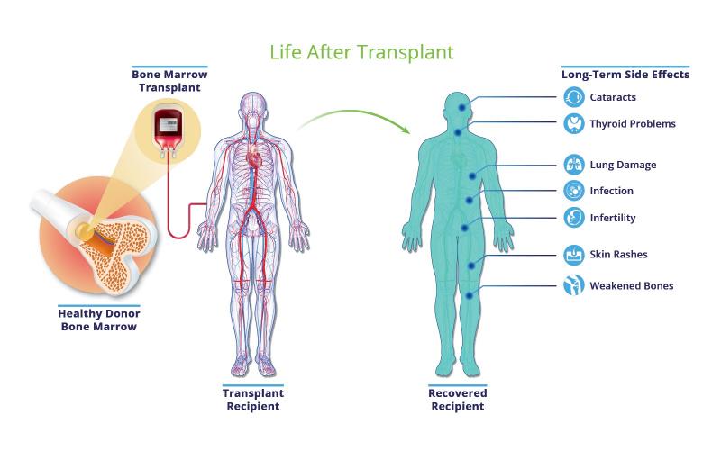 Global Allogeneic Stem Cells Market to Witness a Pronounce