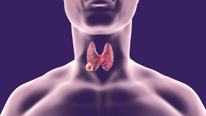 Anaplastic Thyroid Cancer Drug Market