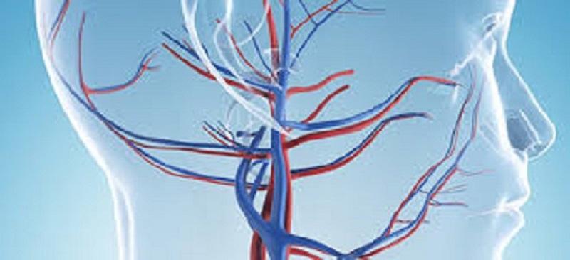 Neurovascular Devices Market Business Opportunities and Growth Challenges Report