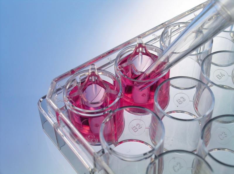 Analysis Report on Cell Culture Market By 2026 | Research Insights On Top Agency Like Thermo Fisher Scientific, Merck Millipore, C