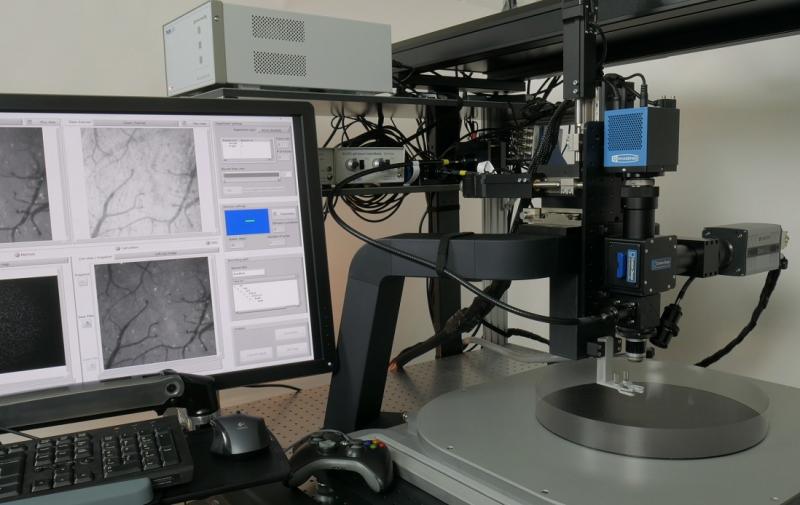 Widefield Imaging Systems Market Impact Analysis for the New Normal| Clarity Medical Systems, Optos Plc (Nikon Corporation), Heide