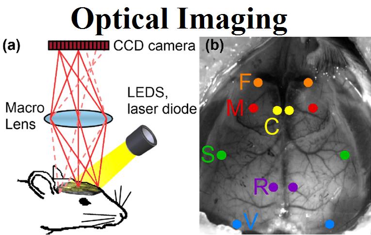 Optical Imaging Market