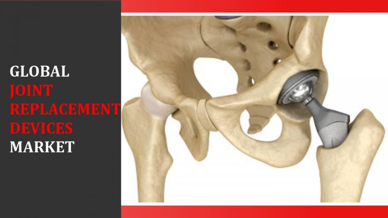 Global Joint Replacement Devices Market