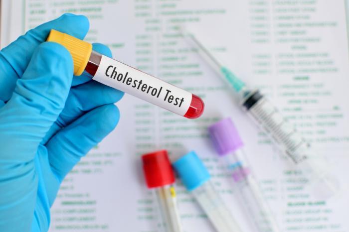 Cholesterol Screening/ Cholesterol Lab Testing Market Size,