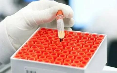 miRNA Tools and Services Market Growth By COVID-19 Spread | Agilent, Asuragen, Bioneer, Bio-Rad, Dharmacon