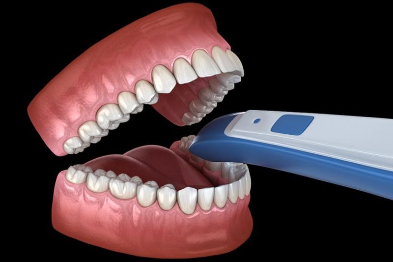 Dental Aligners And Intraoral Scanners Market Research Including with Top Companies Like 3M Company, Henry Schein, Carestream H