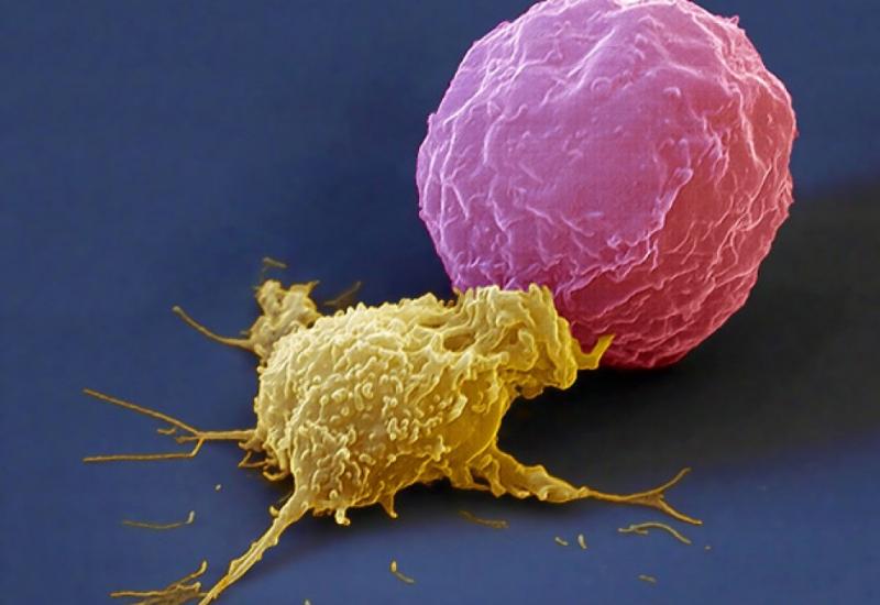 Natural Killer Cells Therapeutics Market See Huge Growth for New Normal| Celgene, Fortress Biotech, Glycostem Therapeutics, Innate