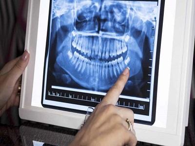 Australia Dental X-Ray Market - TechSci Research