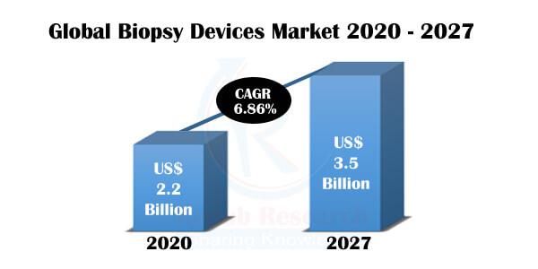As per this research report, Worldwide Biopsy Devices Market is likely to grow at a CAGR of 6.86% by 2021 - 2027.