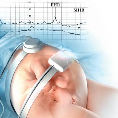 Fetal Monitoring Market Growth by Top Companies with Forecast
