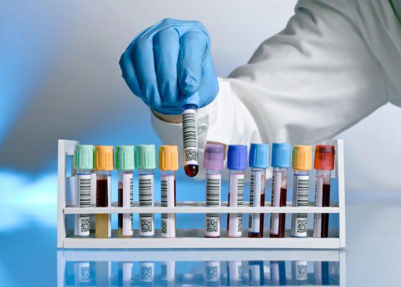 Blood Testing Market Size, Status, Global Outlook 2021-2030