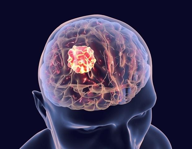 Brain Tumor Diagnosis and Therapeutics Market Research Outlook