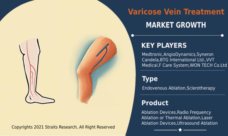 Varicose Vein Treatment Market