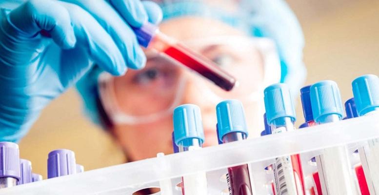 Non-Invasive Liquid Biopsy Market