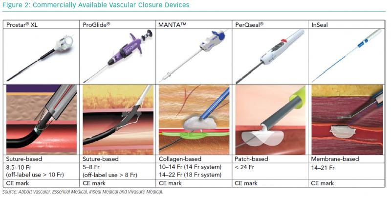 Vascular Closure Devices Market – Global Industry Analysis,