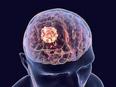 Europe Brain Cancer Diagnostics Market