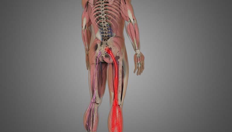 Lumbosacral Radicular Pain Market Outlook 2022