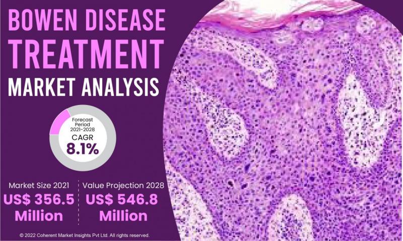 Bowen Disease Treatment