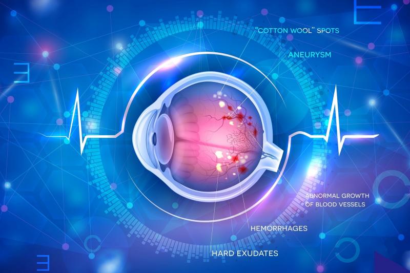 Diabetic Retinopathy Analysis Software