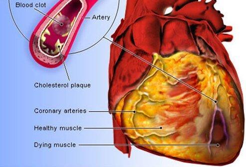 Congestive Heart Failure Drugs Market