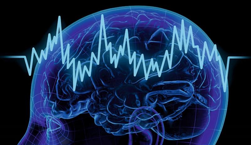 Intraoperative Neuromonitoring Market