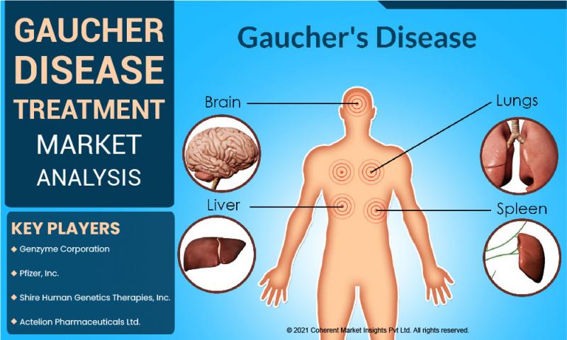 Gaucher Disease Treatment Market