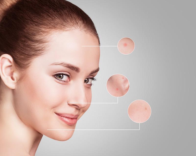 Global Cosmetic Peptide Synthesis Market