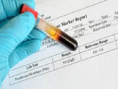 Prostate Specific Antigen (PSA) Testing market