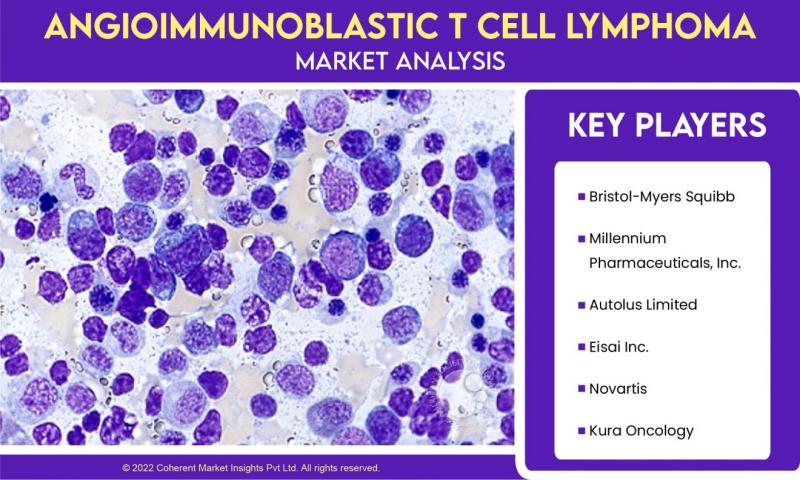 Angioimmunoblastic T Cell Lymphoma Market 2022 - How Business will grow in 2028? | Bristol-Myers Squibb, Millennium Pharmaceuticals, Inc., Autolus Limited, Eisai Inc.