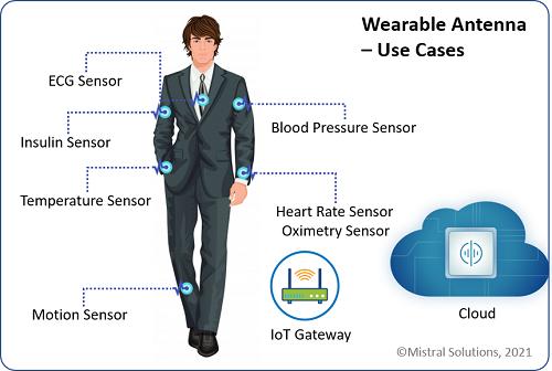 Wearable Antenna Market Sales, Industry Revenue, Regional