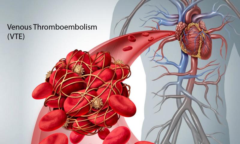 Venous Thromboembolism (VTE) Market