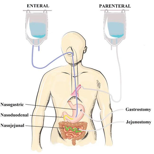 Enteral Nutrition Market