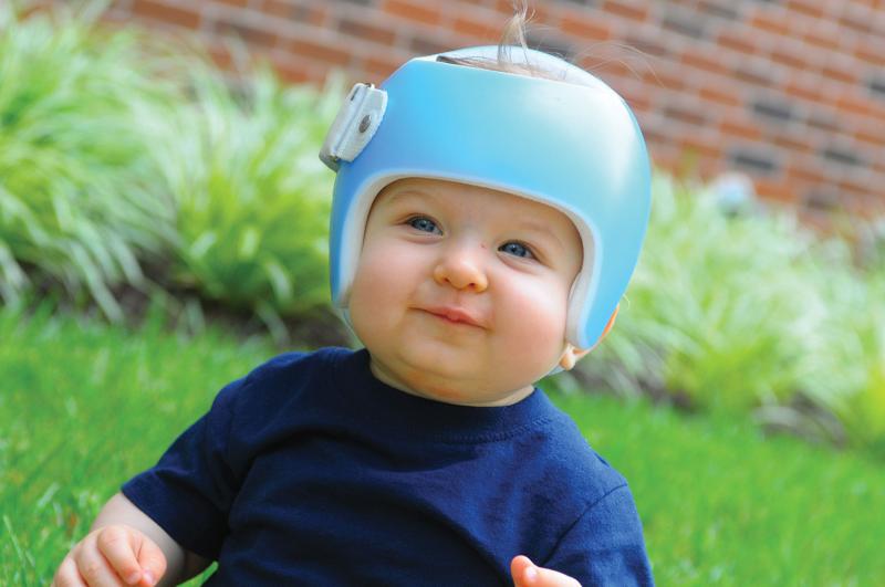 Cranial Molding Helmet Market