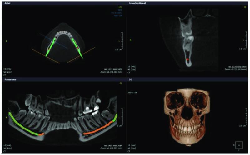 3D Computed Tomography Software Market