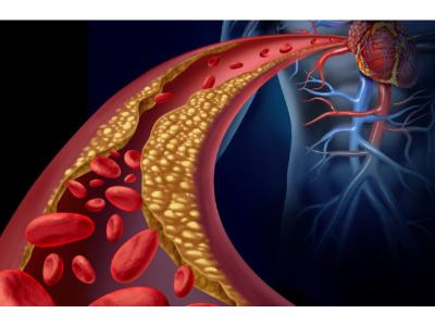 Heart Failure POC & LOC Devices Market