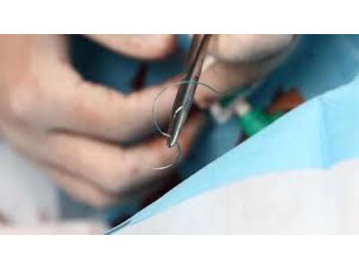 Surgical Stitching Products Market