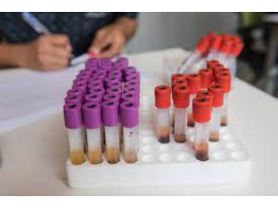 Creatinine Test Market