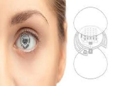 Contact Lenses Market