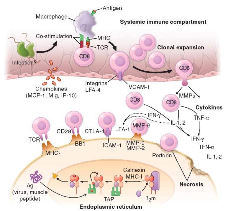 Necrotizing Autoimmune Myositis