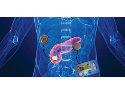 Artificial Pancreas Device System Market