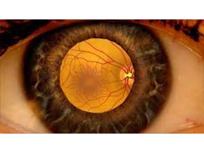 Diabetic Macular Edema Market