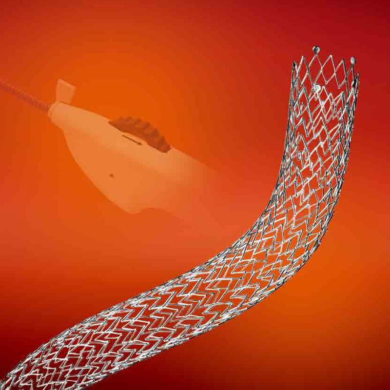 Global Self-Expanding Stents Market