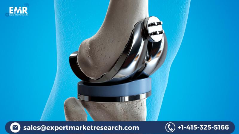 Global Orthopaedic Implants Market Size To Grow At A CAGR Of 5%