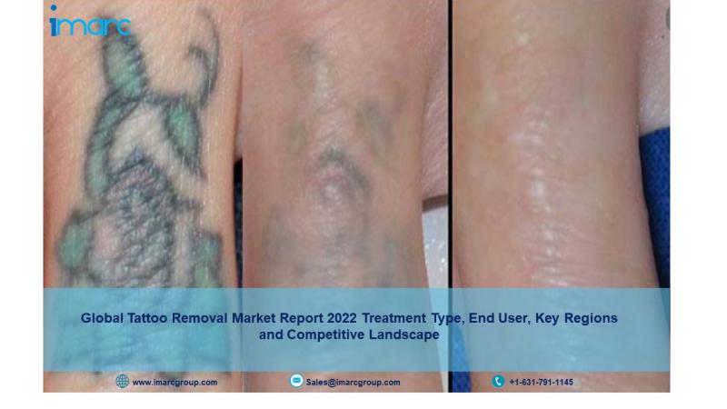 These 9 Factors Determine Tattoo Removal Success - Westlake Dermatology